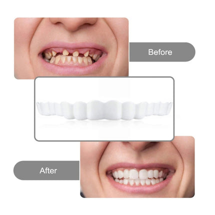 🦷Carillas Snap On Smile  - Sonrisa Perfecta al Instante