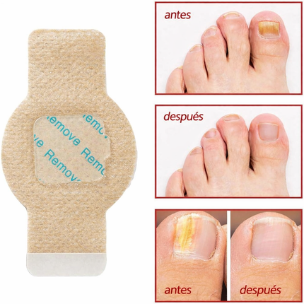 Parches Anti Hongos para Uñas – 21 Pcs, Resultados Reales