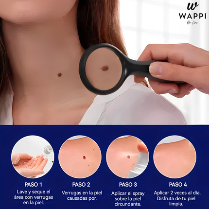Removedor de Verrugas Wart Remover Spray (30 ml) – Elimina Verrugas en Casa, Sin Dolor y con Precisión