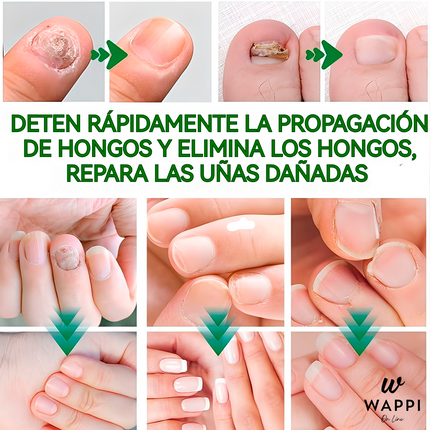 👣Serum Jaysuing: Uñas Fuertes, Claras y Saludables en 7 Días✨💅