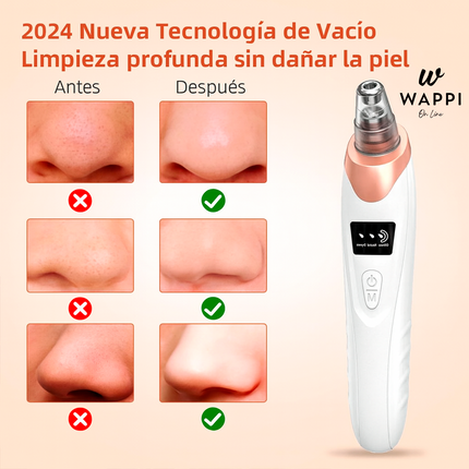 Limpiador de Puntos Negros Recargable USB– Piel Limpia, Suave y Sin Marcas Desde Casa