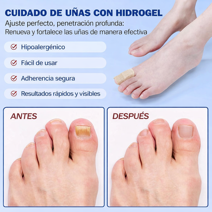 Parches Anti Hongos para Uñas – 21 Pcs, Resultados Reales