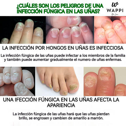 👣Serum Jaysuing: Uñas Fuertes, Claras y Saludables en 7 Días✨💅