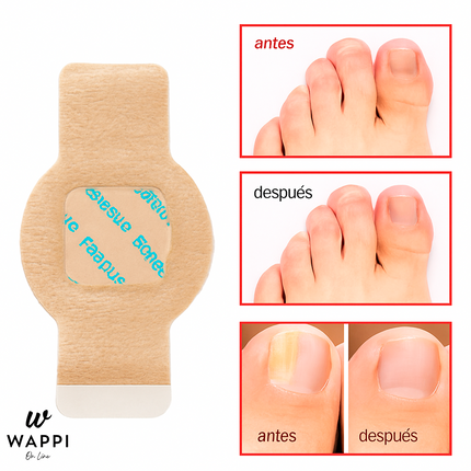 💅Parches Reparadores para Uñas con Hongos (Pack 21)