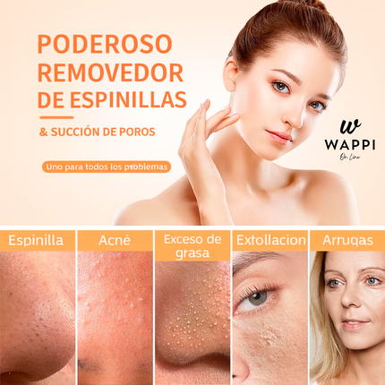 Limpiador de Puntos Negros Recargable USB– Piel Limpia, Suave y Sin Marcas Desde Casa