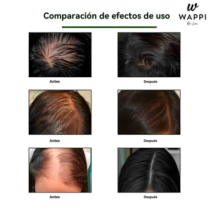 Elixir Capilar Ouhoe 100ml Control De Caida Y Crecimiento De Cabello - Recupera y Fortalece