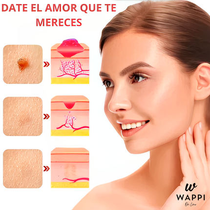 Removedor de Verrugas Wart Remover Spray (30 ml) – Elimina Verrugas en Casa, Sin Dolor y con Precisión
