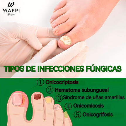 👣Serum Jaysuing: Uñas Fuertes, Claras y Saludables en 7 Días✨💅