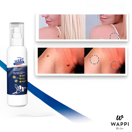 Removedor de Verrugas Wart Remover Spray (30 ml) – Elimina Verrugas en Casa, Sin Dolor y con Precisión