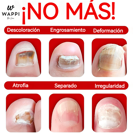 👣Serum Jaysuing: Uñas Fuertes, Claras y Saludables en 7 Días✨💅
