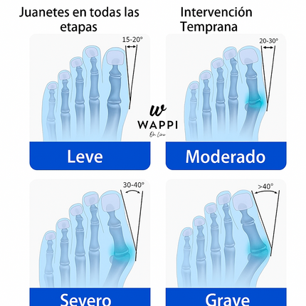 Corrector de Juanetes Ajustable – Alivio y Alineación Natural del Pie